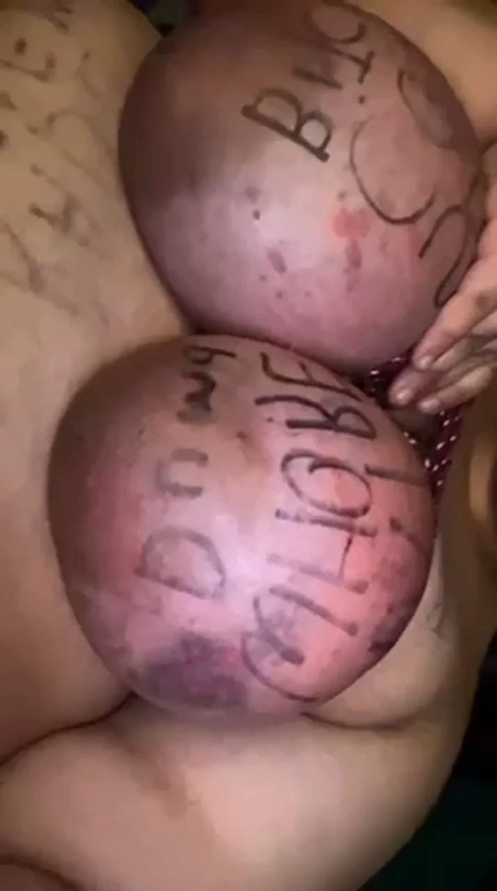 Body writing and bruising 🥰