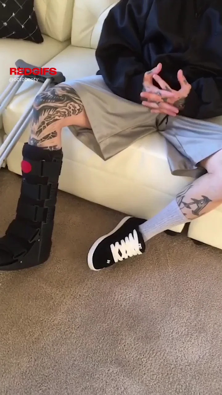 Met this guy with a broken foot and talked him into coming over to give me a creampie