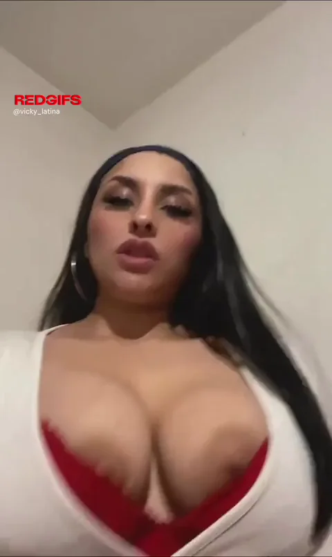 Areolas