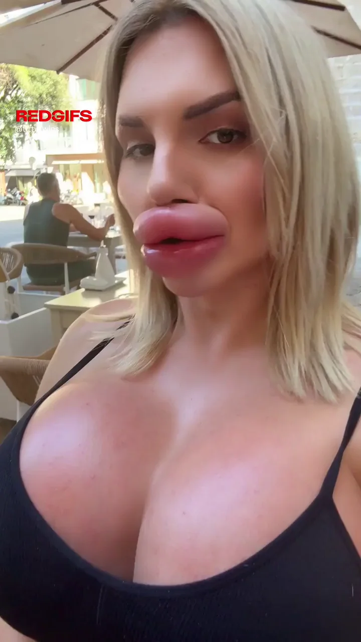 Do you want to kiss them?