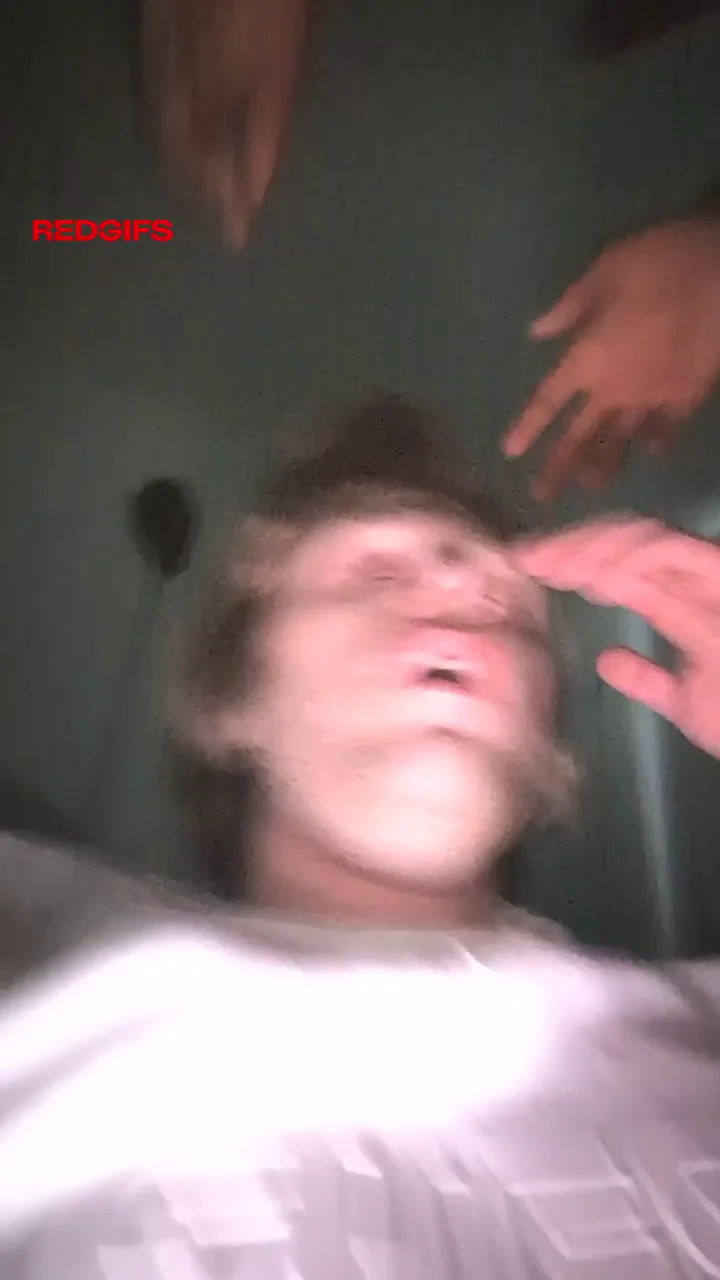 I told him to stop fucking my gf so he did this to me...