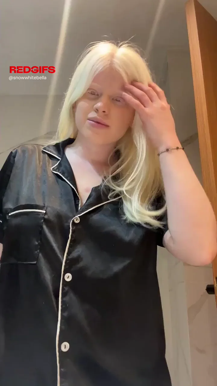 Do men even like albino boobs