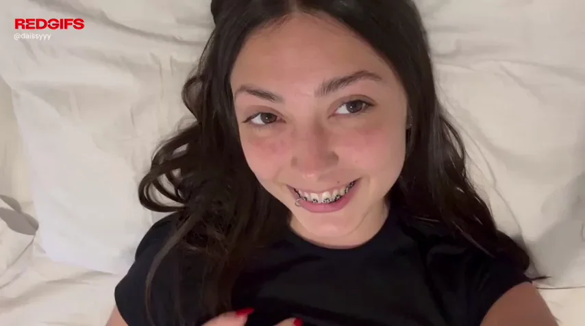 Does may Braces make you hard today x