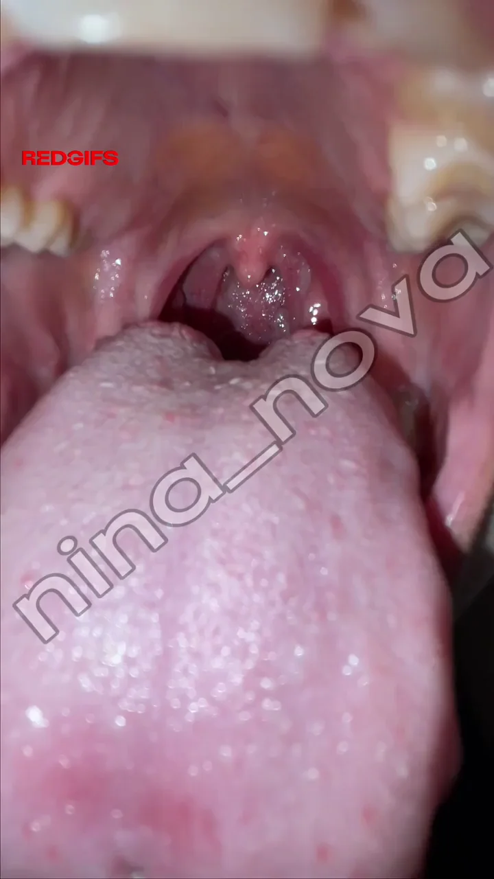 Some nice hocking and throat spitting for you