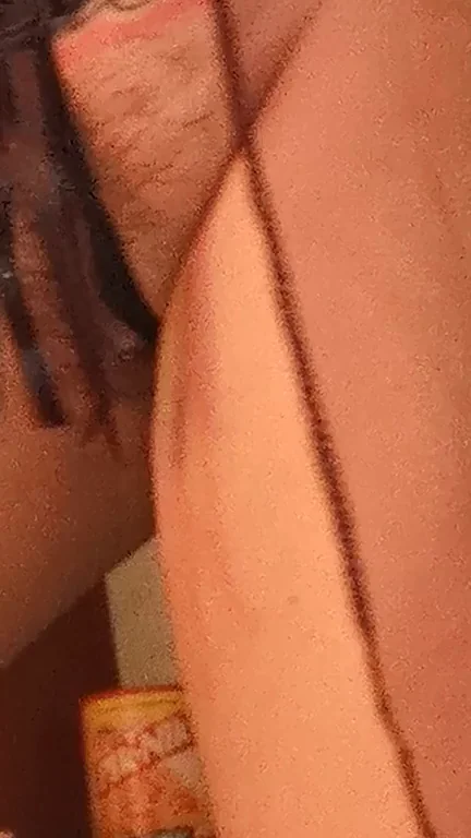 (F41) ?