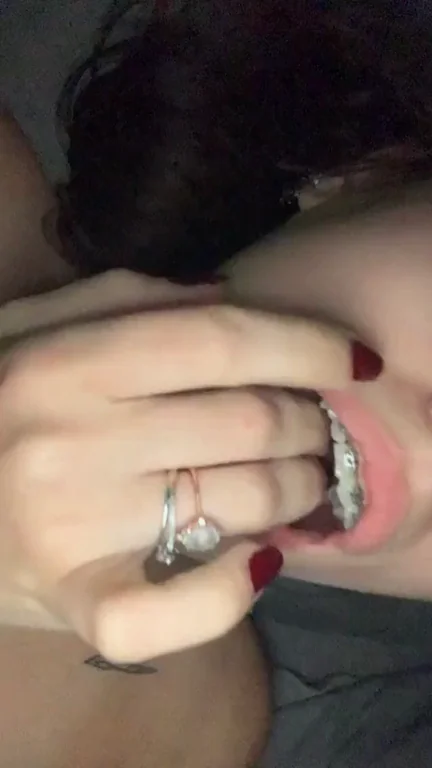 Cute brace face