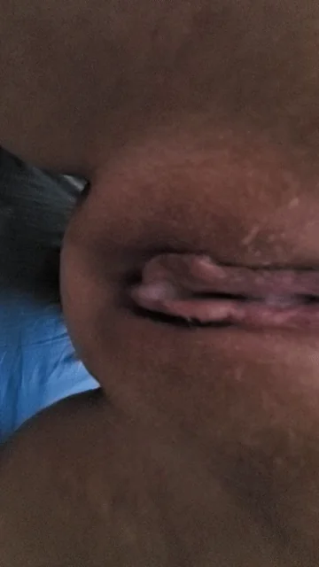 A[F]termath