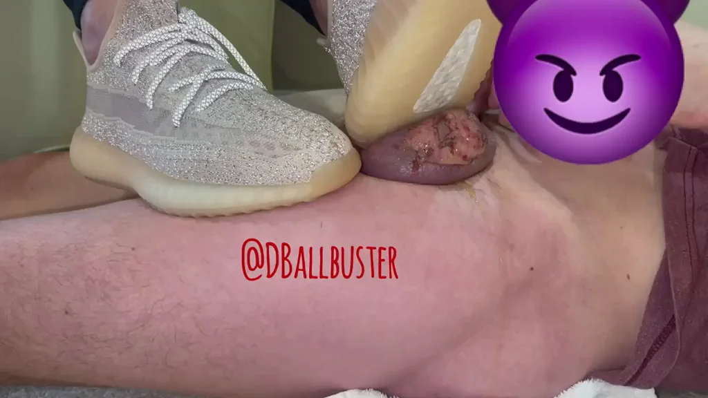 I hate Mondays… and Balls! ? still not healed from the burns but that doesn’t stop me from crushing the juice out of them! ?? watch it ooze at the end.