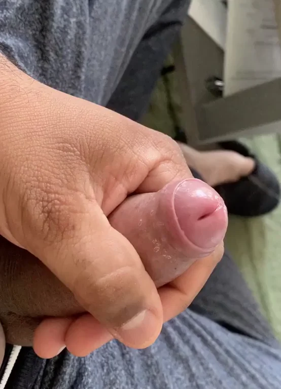 First video showing head (m) ?? ??
