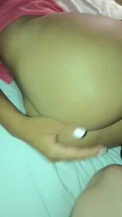 Wish this wasn’t my hand (F22)