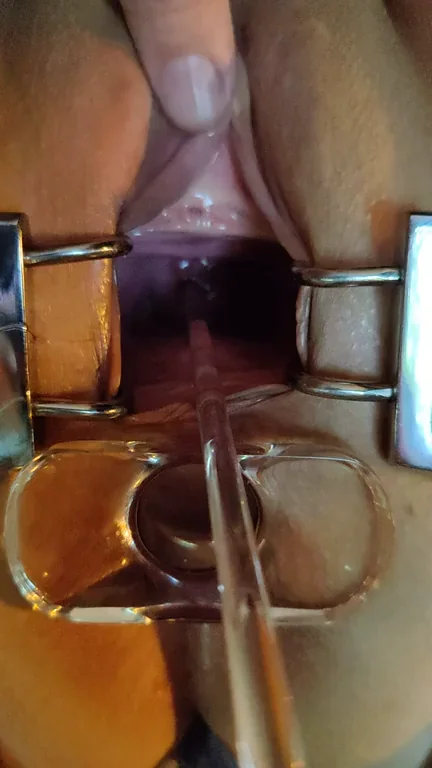 Pussy Speculum Stretch: Hardcore Gape Challenge