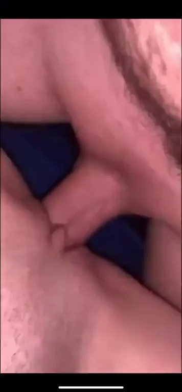 Finally getting my filling ?