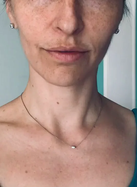 ?