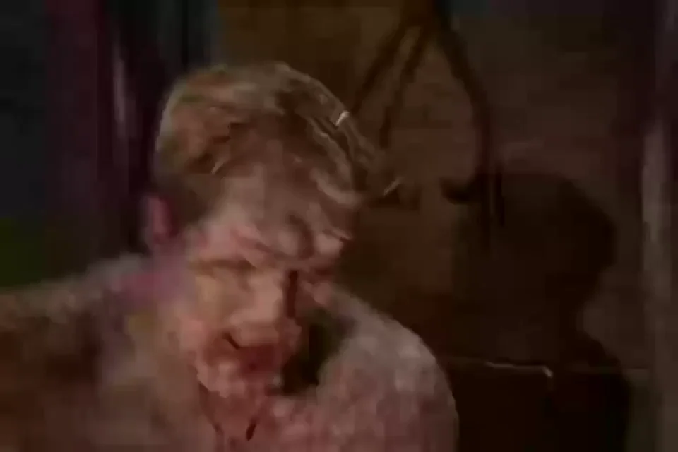 Leprosy Fuck Fest 😷🍆💦
