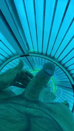 [54] Happens everytime I go tan