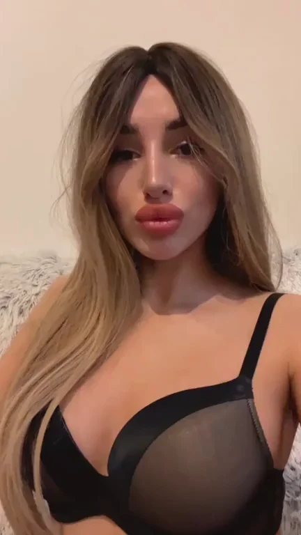 I want fake tits to match my big juicy blowjob lips