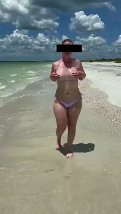 I forgot to put sunscreen on them ?