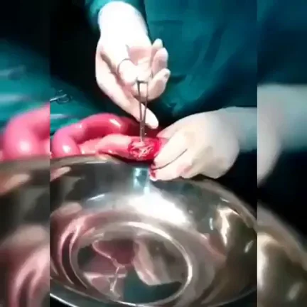 Spaghetti that fights back